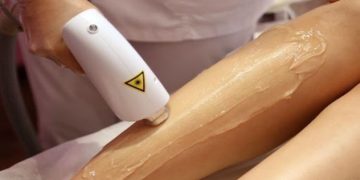 Is Laser Hair Removal Right for You