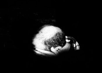 What Are The Most Popular Solutions For Balding Today?