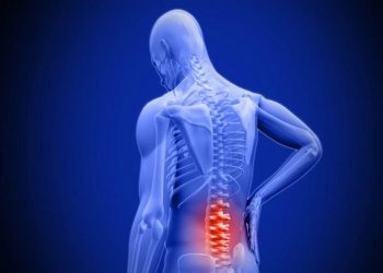 Your Guide to Lumbar Spinal Stenosis Doctors in Fort Myers, FL