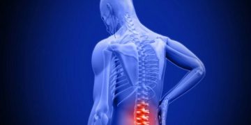 Your Guide to Lumbar Spinal Stenosis Doctors in Fort Myers, FL