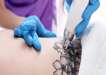 Say Goodbye to Regrets: The Art of Laser Tattoo Removal