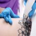 Say Goodbye to Regrets: The Art of Laser Tattoo Removal