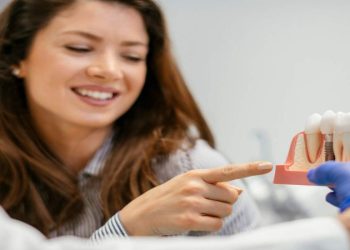 Considering Dental Implants? Here’s What You Should Know Beforehand
