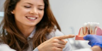 Considering Dental Implants? Here’s What You Should Know Beforehand