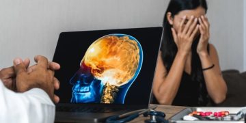 How to Counter Insurance Companies After a TBI