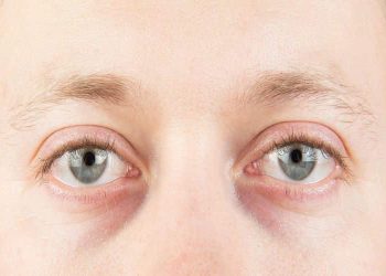 5 Compelling Reasons for Juvederm on Eye Bags and Dark Circles