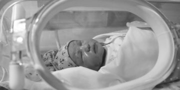 Caring for Preterm Babies: Special Considerations for Parents
