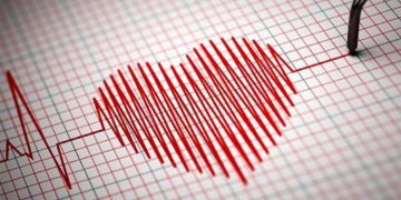 Divorce Stress Syndrome and Impact on Health