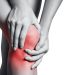 5 Condition That Can Cause Chronic Knee Pain