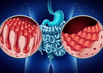 Deciphering Celiac Disease: Unraveling the Intricacies of Gluten Sensitivity