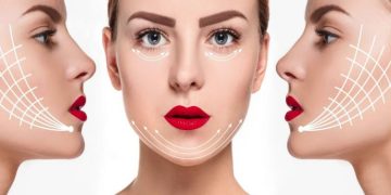Thread Lift vs. Facelift – Which One Fits Your Aesthetic Goals? 