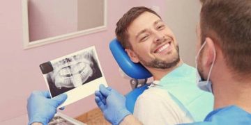 What Are the Key Benefits of the Hollywood Smile