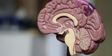 What is White Matter? & How Can It be Repaired