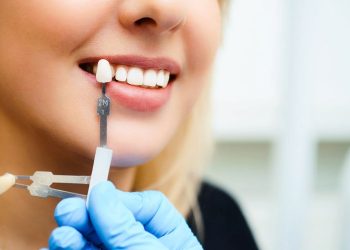 Smile Makeovers: All-on-4, Invisalign Cost, and Affordable Veneers
