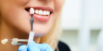 Smile Makeovers: All-on-4, Invisalign Cost, and Affordable Veneers