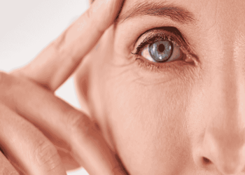 Signs of Aging on the Face and What Can Help