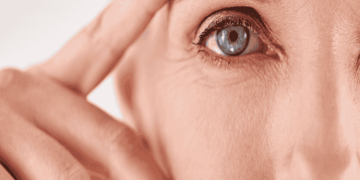 Signs of Aging on the Face and What Can Help