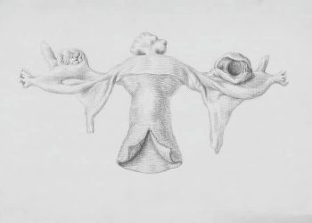 Understanding Uterine Fibroid Embolization: Benefits and Procedure