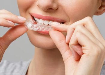 Balancing Invisalign Care and Holiday Celebrations in Raleigh