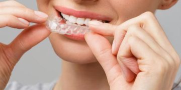 Balancing Invisalign Care and Holiday Celebrations in Raleigh