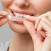 Balancing Invisalign Care and Holiday Celebrations in Raleigh