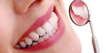 Dentist Aspley Tips for Caring for Your Smile After Teeth Whitening in Brisbane